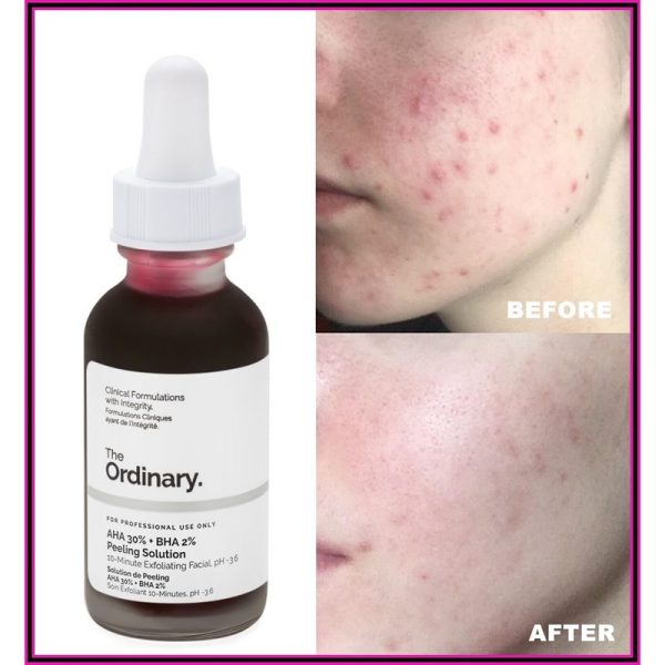 سرم پیلینگ اوردینری لایه بردار قوی The Ordinary AHA 30% + BHA 2% Peeling Solution - Image 4