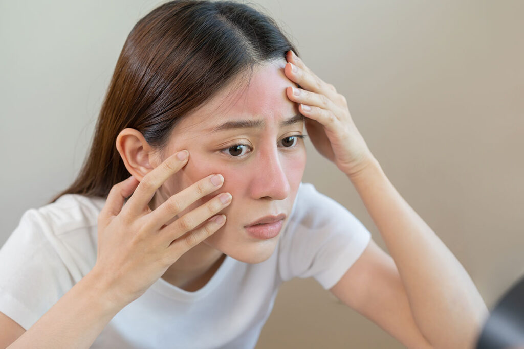 انواع حساسیت های پوست